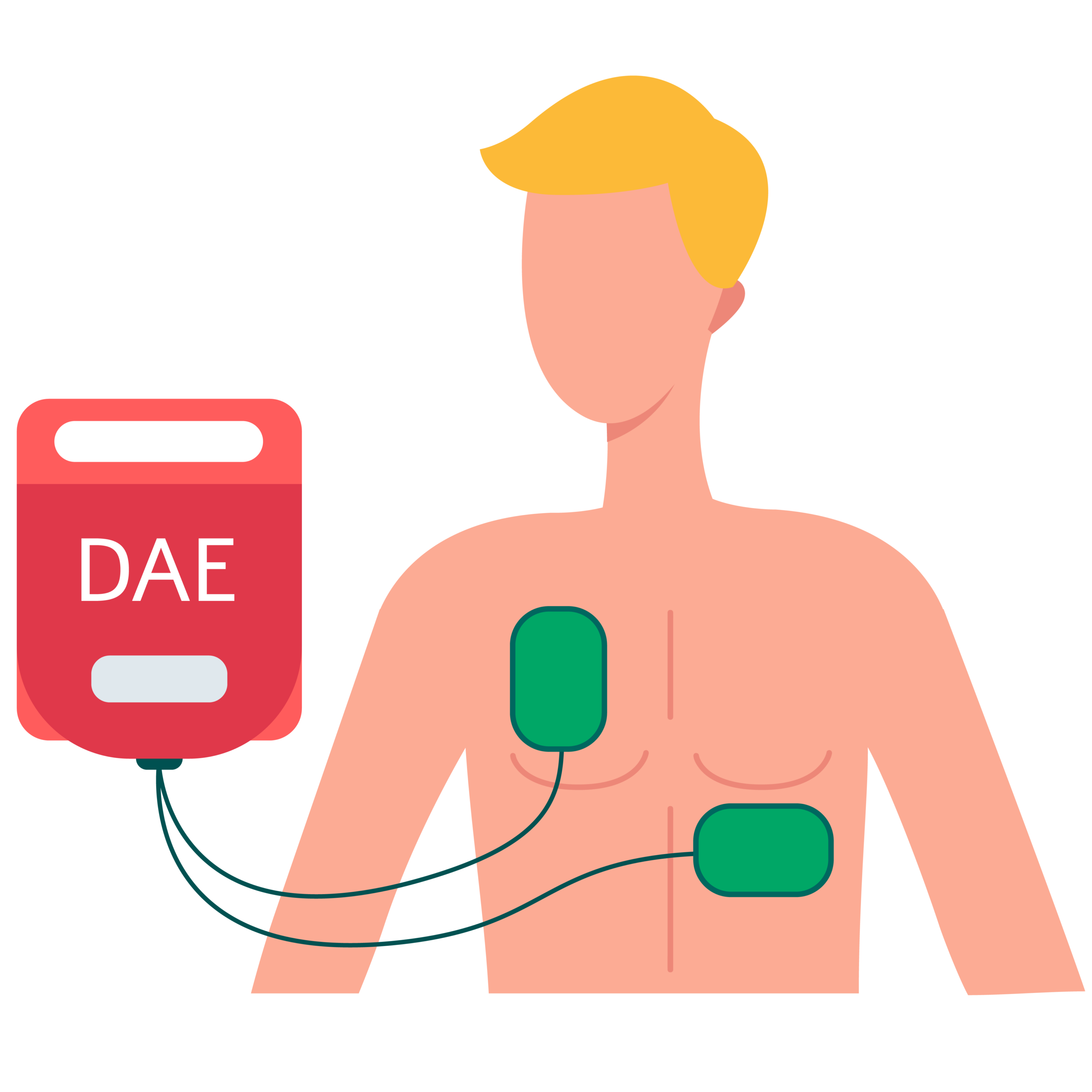 Illustration de placement des électrodes